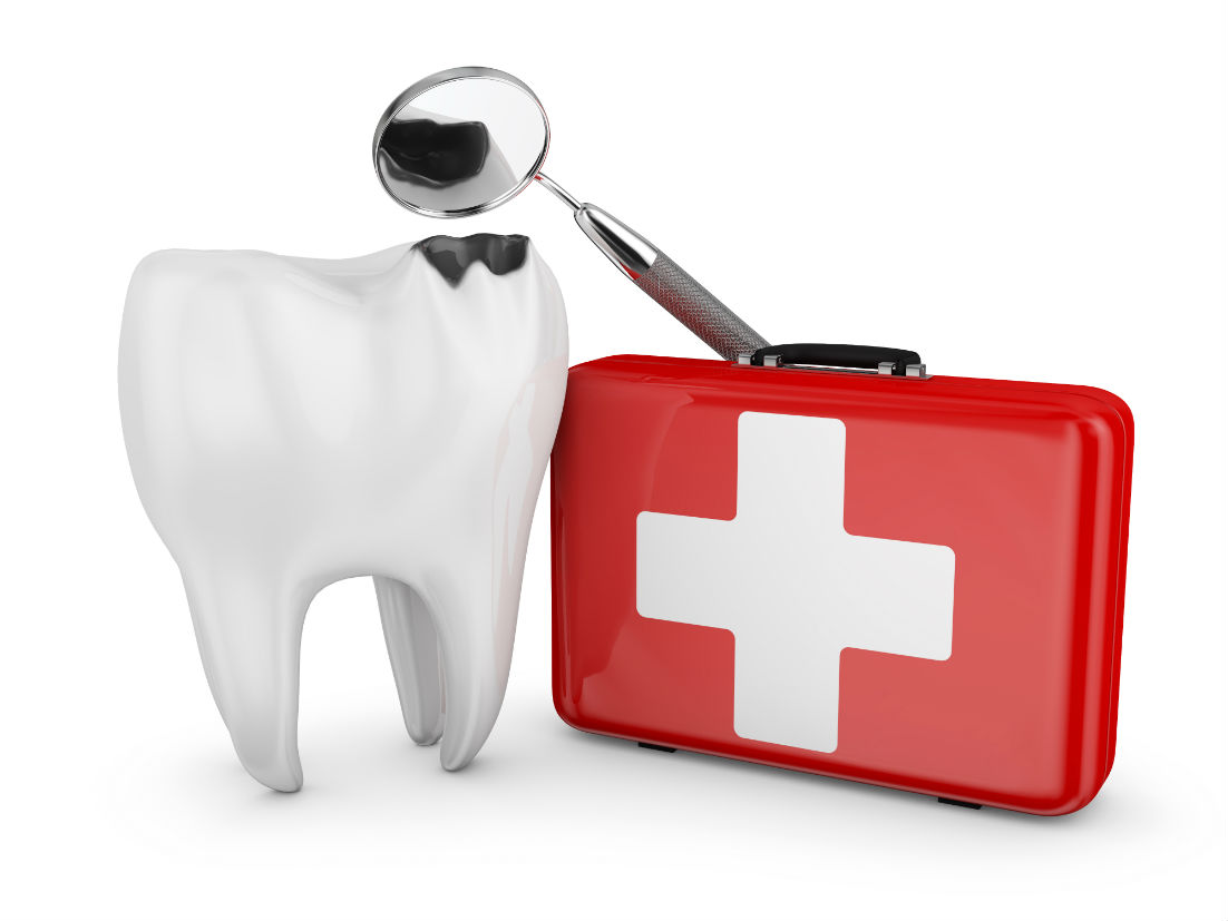 Dental Emergencies 101: How to Handle Common Dental Issues