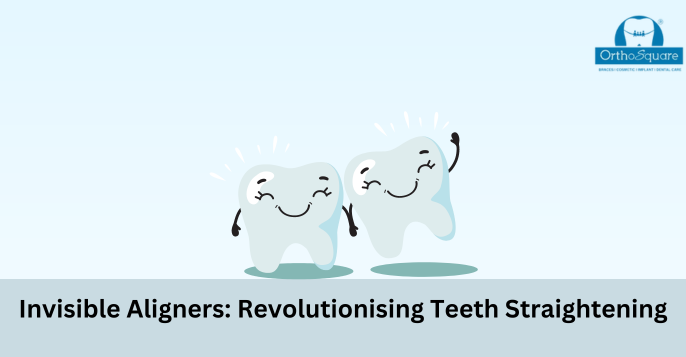 Invisible Aligners: Revolutionising Teeth Straightening