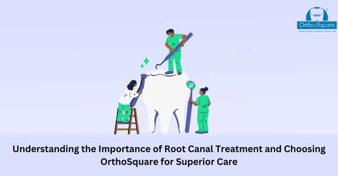 Understanding the Importance of Root Canal Treatment and Choosing OrthoSquare for Superior Care