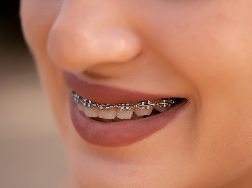 Attention-grabbing Ways To price for teeth cleaning