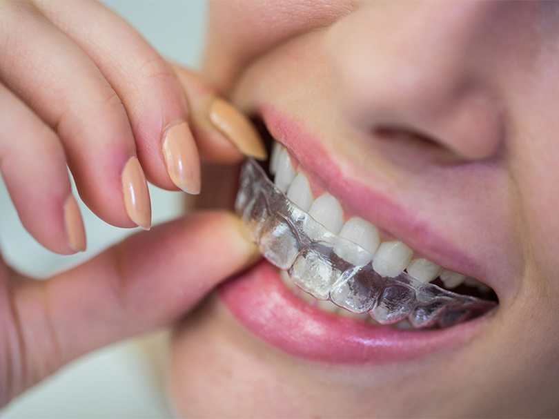 Is tooth prosthesis Making Me Rich?