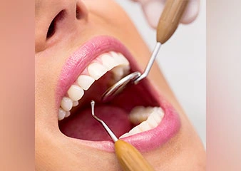 orthosquare Immediate loading teeth in 72 hours