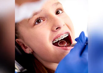 orthosquare braces