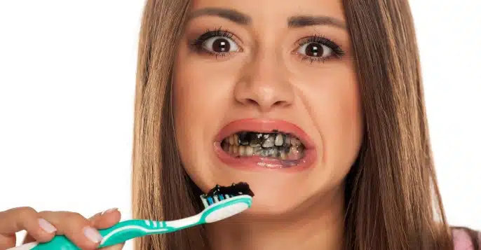 full mouth dental implants