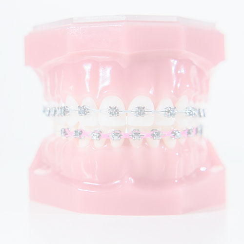 orthosquare teeth braces