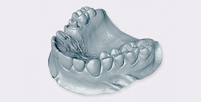 orthosquare complete denture