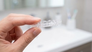 what are aligners