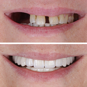 Before and after case 1