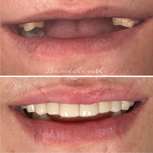 Before and after case 5