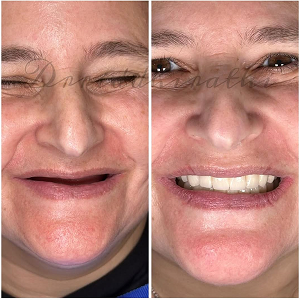 Before and after case 7