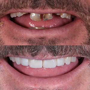 Before and after case 8