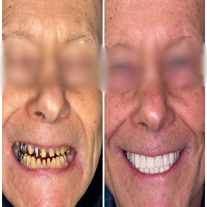 Before and after case 9