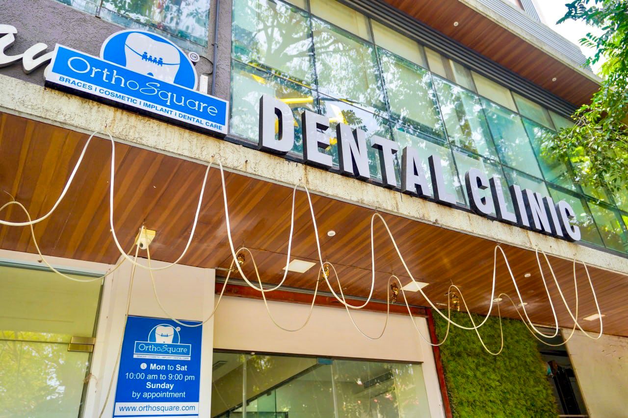 composite fillings Blue Springs Strategies Revealed
